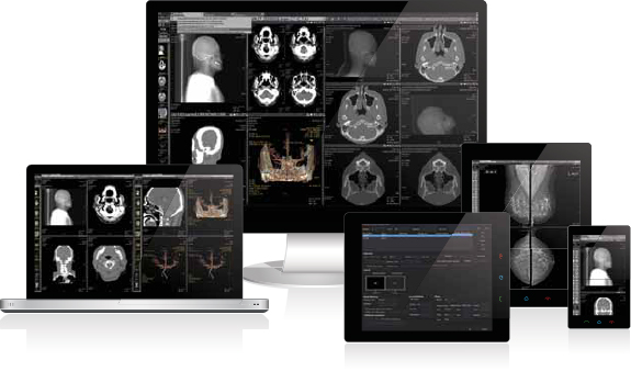 PACS radiography