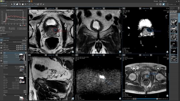 medical imaging software